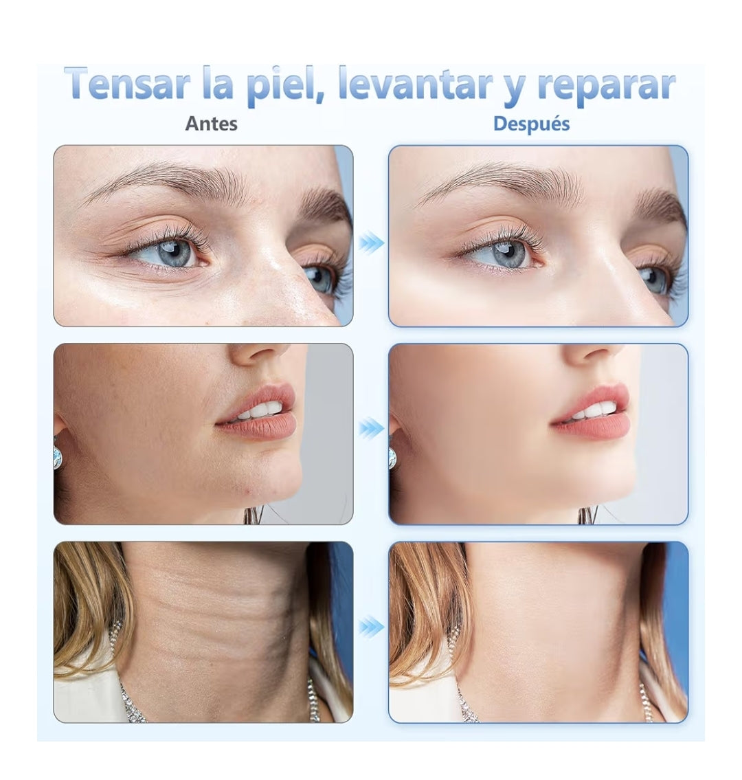 Masajeador Facial StockLíder SL10638 – Tu Nueva Rutina de Rejuvenecimiento en Casa